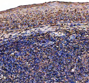 IHC staining of FFPE human tonsil tissue with IL7RA antibody, HRP-secondary and DAB substrate. HIER: boil tissue sections in pH8 EDTA for 20 min and allow to cool before testing.