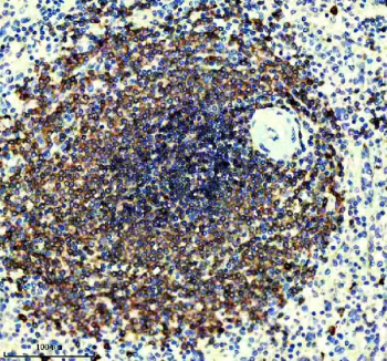 IHC staining of FFPE human spleen tissue with CD22 antibody, HRP-secondary and DAB substrate. HIER: boil tissue sections in pH8 EDTA for 20 min and allow to cool before testing.