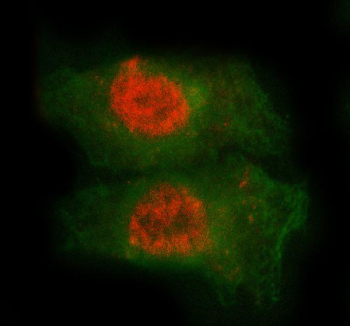 Immunofluorescent staining of FFPE human A549 cells with MED7 antibody (red) and Beta Tubulin mAb (green). HIER: steam section in pH6 citrate buffer for 20 min.