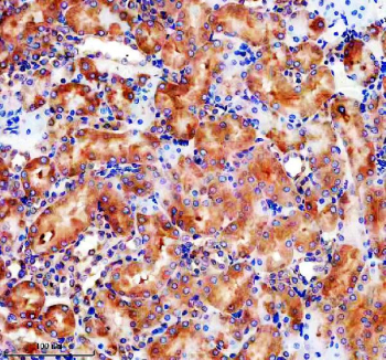 IHC staining of FFPE rat kidney tissue with GLB1 antibody, HRP-secondary and DAB substrate. HIER: boil tissue sections in pH8 EDTA for 20 min and allow to cool before testing.