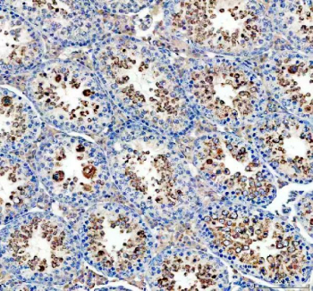 IHC staining of FFPE mouse testis tissue with GPX4 antibody, HRP-secondary and DAB substrate. HIER: boil tissue sections in pH8 EDTA for 20 min and allow to cool before testing.