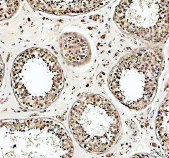 IHC staining of FFPE human testis tissue with USP5 antibody, HRP-secondary and DAB substrate. HIER: boil tissue sections in pH8 EDTA for 20 min and allow to cool before testing.