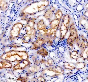 IHC staining of FFPE human kidney tissue with TRAIL-R4 antibody, HRP-secondary and DAB substrate. HIER: boil tissue sections in pH8 EDTA for 20 min and allow to cool before testing.