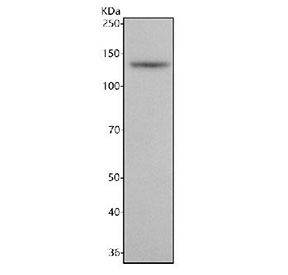 Western blot testing of rat brain tissue lysate with NRCAM antibody. Predicted molecular weight ~144 kDa.