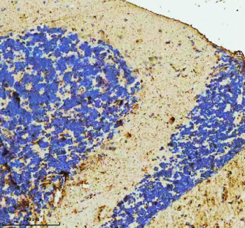 Immunohistochemical analysis of C9orf72 protein using C9orf72 antibody and paraffin-embedded zebrafish brain tissue. HIER: boil tissue sections in pH8 EDTA for 20 min and allow to cool before testing.