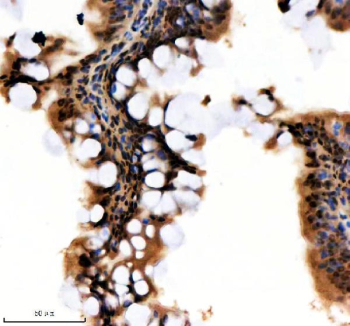 Immunohistochemical analysis of Hnrnpa1a/b protein using Zebrafish Hnrnpa1 antibody and paraffin-embedded zebrafish colon tissue. HIER: boil tissue sections in pH8 EDTA for 20 min and allow to cool before testing.