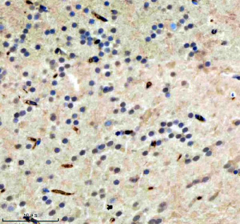 Immunohistochemical analysis of Hdac1 protein using Zebrafish Hdac1 antibody and paraffin-embedded zebrafish brain tissue. HIER: boil tissue sections in pH8 EDTA for 20 min and allow to cool before testing.