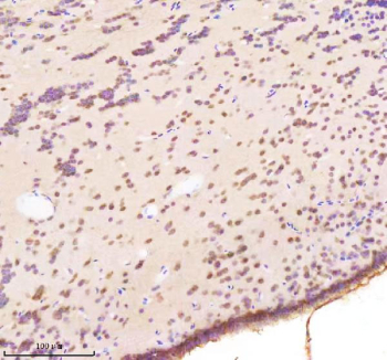 Immunohistochemical analysis of Bap1 protein using Zebrafish Bap1 antibody and paraffin-embedded zebrafish brain tissue. HIER: boil tissue sections in pH8 EDTA for 20 min and allow to cool before testing.