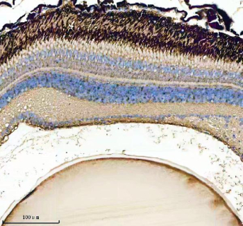 IHC staining of FFPE zebrafish eye tissue with Zebrafish Gnb1 antibody. HIER: boil tissue sections in pH8 EDTA for 20 min and allow to cool before testing.