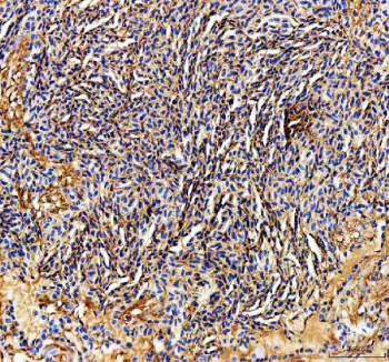 IHC staining of FFPE zebrafish spleen tissue with Zebrafish Ckm antibody. HIER: boil tissue sections in pH8 EDTA for 20 min and allow to cool before testing.