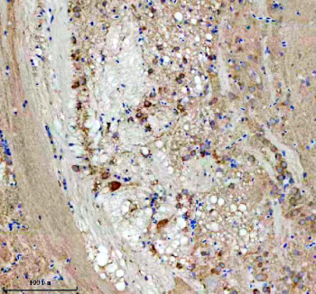 IHC staining of FFPE zebrafish brain tissue with Zebrafish Eif4a1 antibody. HIER: boil tissue sections in pH8 EDTA for 20 min and allow to cool before testing.