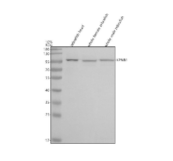 Western blot analysis of Importin Beta/Kpnb1 protein using Zebrafish Kpnb1 antibody and 1) zebrafish head, 2) whole female zebrafish and 3) whole male zebrafish tissue lysate. Predicted molecular weight ~97 kDa.