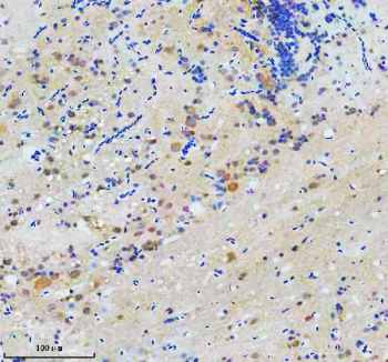 Immunohistochemical analysis of Cct7 protein using Zebrafish Cct7 antibody and paraffin-embedded zebrafish brain tissue. HIER: boil tissue sections in pH8 EDTA for 20 min and allow to cool before testing