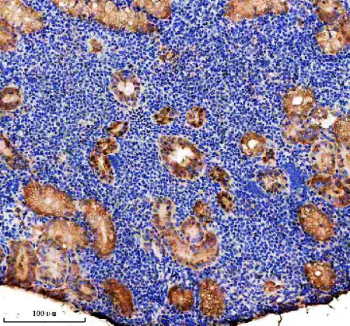 Immunohistochemical analysis of P5CS/ALDH18A1 protein using Zebrafish Aldh18a1 antibody and paraffin-embedded zebrafish kidney tissue. HIER: boil tissue sections in pH8 EDTA for 20 min and allow to cool before testing.
