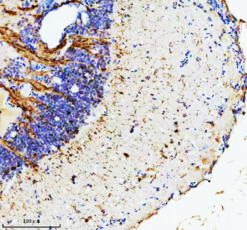 IHC staining of FFPE zebrafish brain tissue with Zebrafish Hypoxanthine phosphoribosyltransferase antibody. HIER: boil tissue sections in pH8 EDTA for 20 min and allow to cool before testing.
