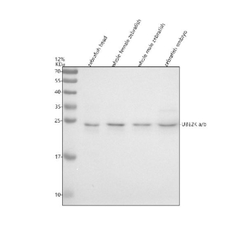 Western blot analysis of UBE2Ka/b protein using Zebrafish Ube2k antibody and 1) zebrafish head, 2) whole female zebrafish, 3) whole male zebrafish and 4) zebrafish embryo tissue lysate. Predicted molecular weight ~22 kDa.
