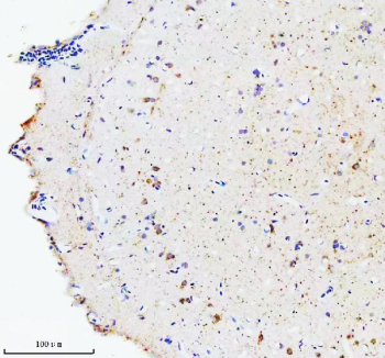 IHC staining of FFPE zebrafish brain tissue with Zebrafish Hsc70 antibody, HRP secondary and DAB substrate. HIER: boil tissue sections in pH8 EDTA for 20 min and allow to cool before testing.