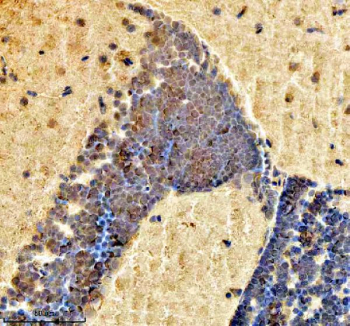 IHC staining of FFPE zebrafish brain tissue with Zebrafish H2ax antibody, HRP secondary and DAB substrate. HIER: boil tissue sections in pH8 EDTA for 20 min and allow to cool before testing.