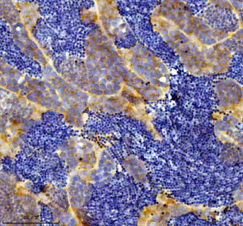 IHC staining of FFPE zebrafish testis tissue with Zebrafish Eif3a antibody, HRP secondary and DAB substrate. HIER: boil tissue sections in pH8 EDTA for 20 min and allow to cool before testing.
