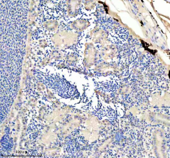 IHC staining of FFPE zebrafish kidney tissue with Zebrafish Eno1 antibody, HRP secondary and DAB substrate. HIER: boil tissue sections in pH8 EDTA for 20 min and allow to cool before testing.