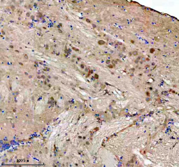 Immunohistochemical analysis of FHL2a/b protein using Zebrafish Fhl2 antibody, HRP secondary and DAB substrate with paraffin-embedded zebrafish brain tissue. HIER: boil tissue sections in pH8 EDTA for 20 min and allow to cool before testing.