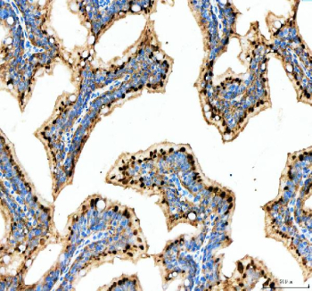 IHC staining of Mettl3 protein using Zebrafish Mettl3 antibody, HRP secondary and DAB substrate with zebrafish colon tissue lysate. HIER: boil tissue sections in pH8 EDTA for 20 min and allow to cool before testing.