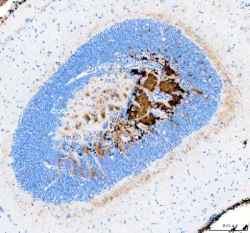 IHC staining of FFPE zebrafish brain tissue with Zebrafish ATP binding cassette E1 antibody, HRP-secondary and DAB substrate. HIER: boil tissue sections in pH8 EDTA for 20 min and allow to cool before testing.