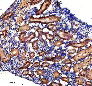 IHC staining of FFPE zebrafish kidney tissue with Zebrafish Dlst antibody, HRP secondary and DAB substrate. HIER: boil tissue sections in pH8 EDTA for 20 min and allow to cool before testing.