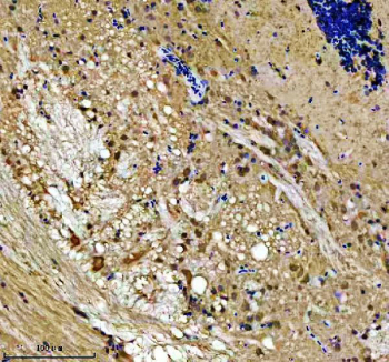 Immunohistochemical analysis of Lsg1 protein using Zebrafish Lsg1 antibody, HPR secondary and DAB substrate with paraffin-embedded zebrafish brain tissue. HIER: boil tissue sections in pH8 EDTA for 20 min and allow to cool before testing.
