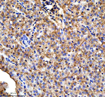 Immunohistochemical analysis of Ttc7b protein using Zebrafish Ttc7b antibody, HRP secondary and DAB substrate with paraffin-embedded zebrafish liver tissue. HIER: boil tissue sections in pH8 EDTA for 20 min and allow to cool before testing.