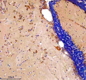 Immunohistochemical analysis of Etf1a/b protein using Zebrafish Etf1 antibody and paraffin-embedded zebrafish brain tissue. HIER: boil tissue sections in pH8 EDTA for 20 min and allow to cool before testing.