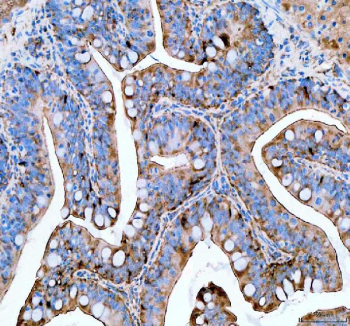 IHC staining of FFPE zebrafish colon tissue with Zebrafish Psmc4 antibody, HRP secondary and DAB substrate. HIER: boil tissue sections in pH8 EDTA for 20 min and allow to cool before testing.