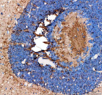 IHC staining of FFPE zebrafish eye tissue with Zebrafish Fshb antibody, HRP-labeled secondary and DAB substrate. HIER: boil tissue sections in pH8 EDTA for 20 min and allow to cool before testing.