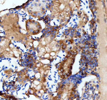 IHC staining of zebrafish Flt1 protein using Zebrafish Flt1 antibody, HRP-labeled secondary and DAB substrate. Flt1 was detected in a paraffin-embedded section of zebrafish kidney tissue. HIER: boil tissue sections in pH8 EDTA for 20 min and allow to cool before testing.