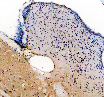 IHC staining of zebrafish Her4 protein using Zebrafish Her4 antibody, HRP-labeled secondary and DAB substrate. Her4 was detected in a paraffin-embedded section of zebrafish brain tissue. HIER: boil tissue sections in pH8 EDTA for 20 min and allow to cool before testing.