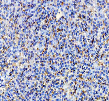 IHC staining of zebrafish Igf2a protein using Zebrafish Igf2a antibody, HRP-labeled secondary and DAB substrate. Igf2a was detected in a paraffin-embedded section of zebrafish liver tissue. HIER: boil tissue sections in pH8 EDTA for 20 min and allow to cool before testing.