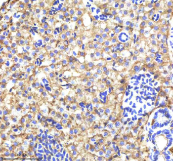 IHC staining of FFPE zebrafish liver tissue with Zebrafish Alcama antibody, HRP-labeled secondary and DAB substrate. HIER: boil tissue sections in pH8 EDTA for 20 min and allow to cool before testing.