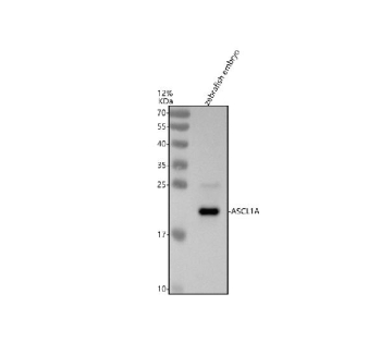 Western blot analysis of Ascl1a protein using Zebrafish Ascl1a antibody and zebrafish embryo tissue lysates. Predicted molecular weight ~22 kDa.