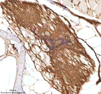 IHC staining of zebrafish Axin2 protein using Zebrafish Axin2 antibody, HRP-labeled secondary and DAB substrate. Axin2 was detected in a paraffin-embedded section of zebrafish spinal cord tissue. HIER: boil tissue sections in pH8 EDTA for 20 min and allow to cool before testing.