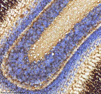 IHC staining of FFPE zebrafish eye tissue with Zebrafish Caspase 9 antibody, HRP-labeled secondary and DAB substrate. HIER: boil tissue sections in pH8 EDTA for 20 min and allow to cool before testing.