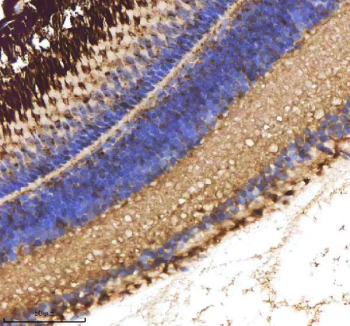 IHC staining of zebrafish Cxcl8a protein using Zebrafish Cxcl8a antibody, HRP-labeled secondary and DAB substrate. Cxcl8a was detected in a paraffin-embedded section of zebrafish eye tissue. HIER: boil tissue sections in pH8 EDTA for 20 min and allow to cool before testing.