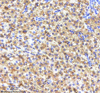 Western blot analysis of FASN protein using Zebrafish FASN antibody. Electrophoresis was performed on a 8% SDS-PAGE gel at 80V (Stacking gel) / 120V (Resolving gel) for 2 hours. Lane 1: zebrafish head tissue lysates.