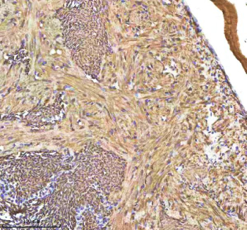 IHC staining of FFPE zebrafish heart tissue with Hbae1.1 antibody, HRP-labeled secondary and DAB substrate. HIER: boil tissue sections in pH8 EDTA for 20 min and allow to cool before testing.
