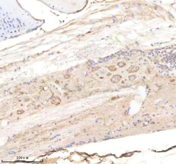IHC staining of FFPE zebrafish spinal cord tissue with Pik3cb antibody, HRP-labeled secondary and DAB substrate. HIER: boil tissue sections in pH8 EDTA for 20 min and allow to cool before testing.