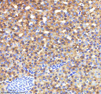 IHC staining of FFPE zebrafish liver tissue with Zebrafish Lysozyme antibody, HRP-labeled secondary and DAB substrate. HIER: boil tissue sections in pH8 EDTA for 20 min and allow to cool before testing.