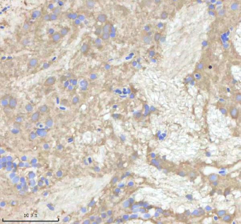 IHC staining of zebrafish Npepps protein using Zebrafish Npepps antibody, HRP-labeled secondary and DAB substrate. Npepps was detected in a paraffin-embedded section of zebrafish brain tissue. HIER: boil tissue sections in pH8 EDTA for 20 min and allow to cool before testing.