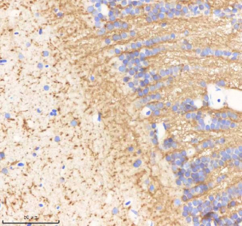 IHC staining of zebrafish Ornithine aminotransferase protein using Zebrafish Ornithine aminotransferase antibody, HRP-labeled secondary and DAB substrate. Ornithine aminotransferase was detected in a paraffin-embedded section of zebrafish brain tissue. HIER: boil tissue sections in pH8 EDTA for 20 min and allow to cool before testing.