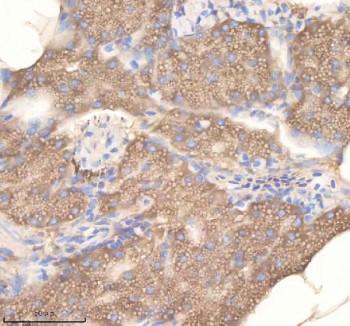 IHC staining of zebrafish Pdcd10a/b protein using Zebrafish Pdcd10 antibody, HRP-labeled secondary and DAB substrate. Pdcd10 was detected in a paraffin-embedded section of zebrafish pancreas tissue. HIER: boil tissue sections in pH8 EDTA for 20 min and allow to cool before testing.
