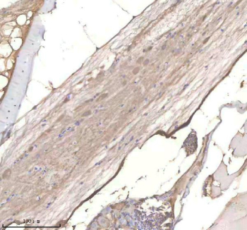 IHC staining of zebrafish Phyhipl/b protein using Zebrafish Phyhipl antibody, HRP-labeled secondary and DAB substrate. Phyhipl was detected in a paraffin-embedded section of zebrafish spinal tissue. HIER: boil tissue sections in pH8 EDTA for 20 min and allow to cool before testing.