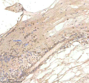 IHC staining of zebrafish Polr2d protein using Zebrafish Polr2d antibody, HRP-labeled secondary and DAB substrate. Polr2d was detected in a paraffin-embedded section of zebrafish spinal tissue. HIER: boil tissue sections in pH8 EDTA for 20 min and allow to cool before testing.